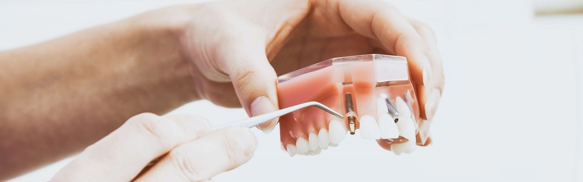 Sprej za nos | Zubni implanti Beograd